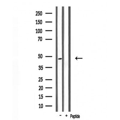 DF3719 staining HT29 by IF/ICC. The sample were fixed with PFA and permeabilized in 0.1% Triton X-100,then blocked in 10% serum for 45 minutes at 25¡ãC. The primary antibody was diluted at 1/200 and incubated with the sample for 1 hour at 37¡ãC. An  Alexa Fluor 594 conjugated goat anti-rabbit IgG (H+L) Ab, diluted at 1/600, was used as the secondary antibod