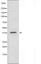 DF3720 staining COLO205 by IF/ICC. The sample were fixed with PFA and permeabilized in 0.1% Triton X-100,then blocked in 10% serum for 45 minutes at 25¡ãC. The primary antibody was diluted at 1/200 and incubated with the sample for 1 hour at 37¡ãC. An  Alexa Fluor 594 conjugated goat anti-rabbit IgG (H+L) Ab, diluted at 1/600, was used as the secondary antibod