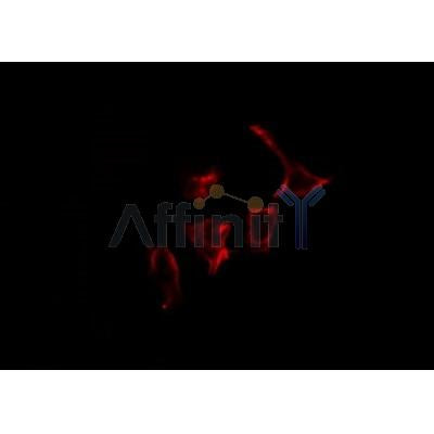 AF0389 staining COLO205 by IF/ICC. The sample were fixed with PFA and permeabilized in 0.1% Triton X-100,then blocked in 10% serum for 45 minutes at 25¡ãC. The primary antibody was diluted at 1/200 and incubated with the sample for 1 hour at 37¡ãC. An  Alexa Fluor 594 conjugated goat anti-rabbit IgG (H+L) Ab, diluted at 1/600, was used as the secondary antibod