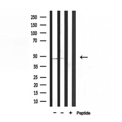 DF3726 staining HepG2 by IF/ICC. The sample were fixed with PFA and permeabilized in 0.1% Triton X-100,then blocked in 10% serum for 45 minutes at 25¡ãC. The primary antibody was diluted at 1/200 and incubated with the sample for 1 hour at 37¡ãC. An  Alexa Fluor 594 conjugated goat anti-rabbit IgG (H+L) Ab, diluted at 1/600, was used as the secondary antibod