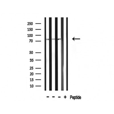 Western blot analysis of extracts of various tissue ,using ACSA antibody