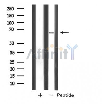 Western blot analysis of SLC33A1 expression in Human Placenta lysate