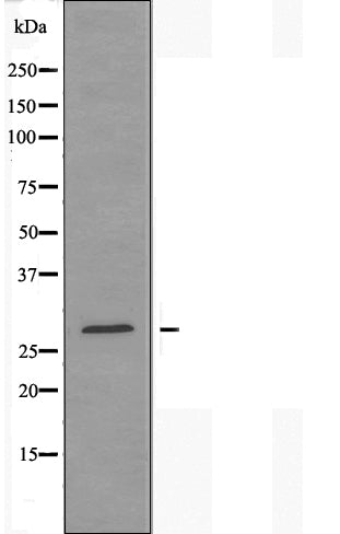 Western blot analysis of extracts from rat brain cells, using ANP32B antibody.