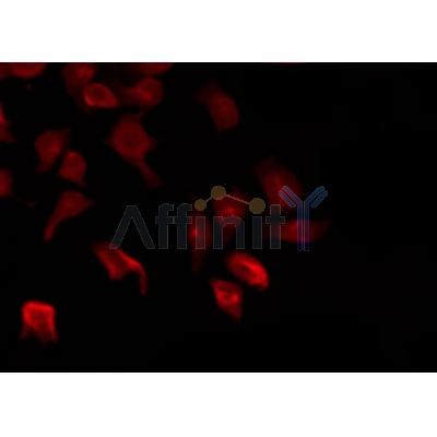 AF0391 staining HeLa by IF/ICC. The sample were fixed with PFA and permeabilized in 0.1% Triton X-100,then blocked in 10% serum for 45 minutes at 25¡ãC. The primary antibody was diluted at 1/200 and incubated with the sample for 1 hour at 37¡ãC. An  Alexa Fluor 594 conjugated goat anti-rabbit IgG (H+L) Ab, diluted at 1/600, was used as the secondary antibod