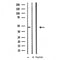 DF3731 staining Hela cells by IF/ICC. The sample were fixed with PFA and permeabilized in 0.1% Triton X-100,then blocked in 10% serum for 45 minutes at 25¡ãC. The primary antibody was diluted at 1/200 and incubated with the sample for 1 hour at 37¡ãC. An  Alexa Fluor 594 conjugated goat anti-rabbit IgG (H+L) antibody(Cat.# S0006), diluted at 1/600, was used as secondary antibod