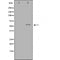DF3734 staining Hela by IF/ICC. The sample were fixed with PFA and permeabilized in 0.1% Triton X-100,then blocked in 10% serum for 45 minutes at 25¡ãC. The primary antibody was diluted at 1/200 and incubated with the sample for 1 hour at 37¡ãC. An  Alexa Fluor 594 conjugated goat anti-rabbit IgG (H+L) Ab, diluted at 1/600, was used as the secondary antibod