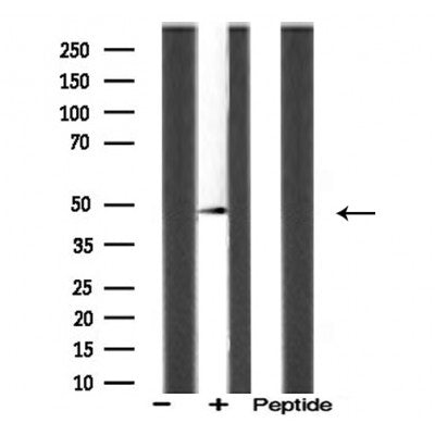 DF3735 staining HeLa by IF/ICC. The sample were fixed with PFA and permeabilized in 0.1% Triton X-100,then blocked in 10% serum for 45 minutes at 25¡ãC. The primary antibody was diluted at 1/200 and incubated with the sample for 1 hour at 37¡ãC. An  Alexa Fluor 594 conjugated goat anti-rabbit IgG (H+L) Ab, diluted at 1/600, was used as the secondary antibod