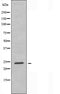 DF3737 staining COLO205 cells by IF/ICC. The sample were fixed with PFA and permeabilized in 0.1% Triton X-100,then blocked in 10% serum for 45 minutes at 25¡ãC. The primary antibody was diluted at 1/200 and incubated with the sample for 1 hour at 37¡ãC. An  Alexa Fluor 594 conjugated goat anti-rabbit IgG (H+L) antibody(Cat.# S0006), diluted at 1/600, was used as secondary antibod