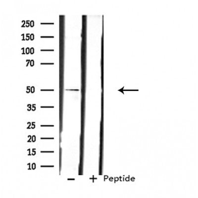 Western blot analysis of extracts from rat heart, using LPCAT2 Antibody. Lane 1 was treated with the blocking peptide.
