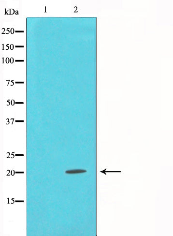 Western blot analysis on mouse brain cell lysate using Alpha-synuclein Antibody,The lane on the left is treated with the antigen-specific peptide.