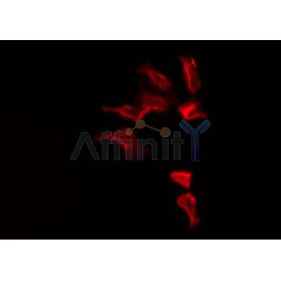 Western blot analysis of extracts from 293, using SLC25A6 Antibody.