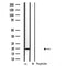 DF3746 staining COLO205 cells by IF/ICC. The sample were fixed with PFA and permeabilized in 0.1% Triton X-100,then blocked in 10% serum for 45 minutes at 25¡ãC. The primary antibody was diluted at 1/200 and incubated with the sample for 1 hour at 37¡ãC. An  Alexa Fluor 594 conjugated goat anti-rabbit IgG (H+L) antibody(Cat.# S0006), diluted at 1/600, was used as secondary antibod