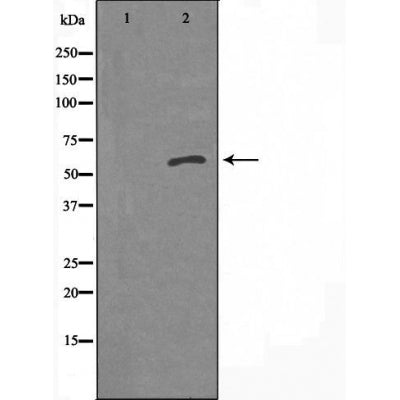 DF3747 staining HeLa cells by IF/ICC. The sample were fixed with PFA and permeabilized in 0.1% Triton X-100,then blocked in 10% serum for 45 minutes at 25¡ãC. The primary antibody was diluted at 1/200 and incubated with the sample for 1 hour at 37¡ãC. An  Alexa Fluor 594 conjugated goat anti-rabbit IgG (H+L) antibody(Cat.# S0006), diluted at 1/600, was used as secondary antibod
