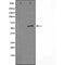 DF3747 staining HeLa cells by IF/ICC. The sample were fixed with PFA and permeabilized in 0.1% Triton X-100,then blocked in 10% serum for 45 minutes at 25¡ãC. The primary antibody was diluted at 1/200 and incubated with the sample for 1 hour at 37¡ãC. An  Alexa Fluor 594 conjugated goat anti-rabbit IgG (H+L) antibody(Cat.# S0006), diluted at 1/600, was used as secondary antibod