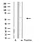DF3748 staining HeLa cells by IF/ICC. The sample were fixed with PFA and permeabilized in 0.1% Triton X-100,then blocked in 10% serum for 45 minutes at 25¡ãC. The primary antibody was diluted at 1/200 and incubated with the sample for 1 hour at 37¡ãC. An  Alexa Fluor 594 conjugated goat anti-rabbit IgG (H+L) antibody(Cat.# S0006), diluted at 1/600, was used as secondary antibod