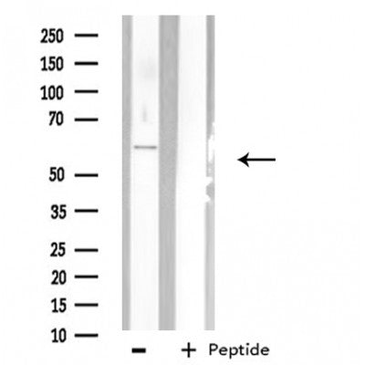 DF3750 staining Hela by IF/ICC. The sample were fixed with PFA and permeabilized in 0.1% Triton X-100,then blocked in 10% serum for 45 minutes at 25¡ãC. The primary antibody was diluted at 1/200 and incubated with the sample for 1 hour at 37¡ãC. An  Alexa Fluor 594 conjugated goat anti-rabbit IgG (H+L) Ab, diluted at 1/600, was used as the secondary antibod