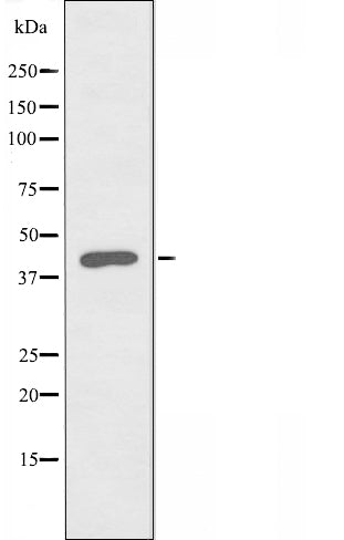 DF3751 staining A549 by IF/ICC. The sample were fixed with PFA and permeabilized in 0.1% Triton X-100,then blocked in 10% serum for 45 minutes at 25¡ãC. The primary antibody was diluted at 1/200 and incubated with the sample for 1 hour at 37¡ãC. An  Alexa Fluor 594 conjugated goat anti-rabbit IgG (H+L) Ab, diluted at 1/600, was used as the secondary antibod