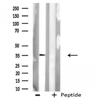 DF3752 staining COLO205 cells by IF/ICC. The sample were fixed with PFA and permeabilized in 0.1% Triton X-100,then blocked in 10% serum for 45 minutes at 25¡ãC. The primary antibody was diluted at 1/200 and incubated with the sample for 1 hour at 37¡ãC. An  Alexa Fluor 594 conjugated goat anti-rabbit IgG (H+L) antibody(Cat.# S0006), diluted at 1/600, was used as secondary antibod