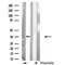 DF3752 staining COLO205 cells by IF/ICC. The sample were fixed with PFA and permeabilized in 0.1% Triton X-100,then blocked in 10% serum for 45 minutes at 25¡ãC. The primary antibody was diluted at 1/200 and incubated with the sample for 1 hour at 37¡ãC. An  Alexa Fluor 594 conjugated goat anti-rabbit IgG (H+L) antibody(Cat.# S0006), diluted at 1/600, was used as secondary antibod
