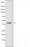 DF3753 staining Hela cells by IF/ICC. The sample were fixed with PFA and permeabilized in 0.1% Triton X-100,then blocked in 10% serum for 45 minutes at 25¡ãC. The primary antibody was diluted at 1/200 and incubated with the sample for 1 hour at 37¡ãC. An  Alexa Fluor 594 conjugated goat anti-rabbit IgG (H+L) antibody(Cat.# S0006), diluted at 1/600, was used as secondary antibod
