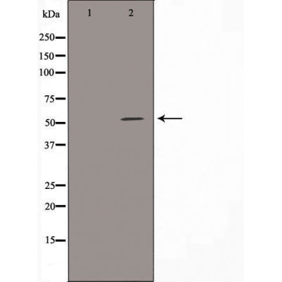 DF3754 at 1/100 staining Human lung tissue by IHC-P. The sample was formaldehyde fixed and a heat mediated antigen retrieval step in citrate buffer was performed. The sample was then blocked and incubated with the antibody for 1.5 hours at 22¡ãC. An HRP conjugated goat anti-rabbit antibody was used as the secondary