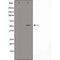 DF3754 at 1/100 staining Human lung tissue by IHC-P. The sample was formaldehyde fixed and a heat mediated antigen retrieval step in citrate buffer was performed. The sample was then blocked and incubated with the antibody for 1.5 hours at 22¡ãC. An HRP conjugated goat anti-rabbit antibody was used as the secondary