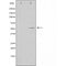 DF3755 staining HepG2 by IF/ICC. The sample were fixed with PFA and permeabilized in 0.1% Triton X-100,then blocked in 10% serum for 45 minutes at 25¡ãC. The primary antibody was diluted at 1/200 and incubated with the sample for 1 hour at 37¡ãC. An  Alexa Fluor 594 conjugated goat anti-rabbit IgG (H+L) Ab, diluted at 1/600, was used as the secondary antibod