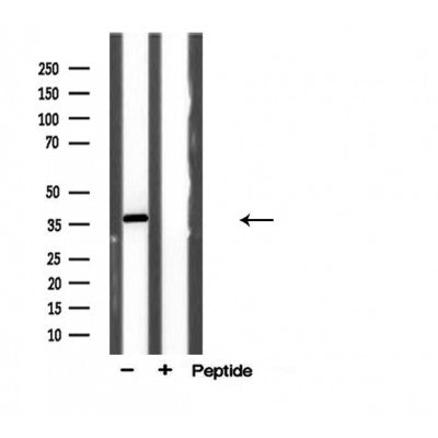 DF3758 staining  A549 cells by IF/ICC. The sample were fixed with PFA and permeabilized in 0.1% Triton X-100,then blocked in 10% serum for 45 minutes at 25¡ãC. The primary antibody was diluted at 1/200 and incubated with the sample for 1 hour at 37¡ãC. An  Alexa Fluor 594 conjugated goat anti-rabbit IgG (H+L) antibody(Cat.# S0006), diluted at 1/600, was used as secondary antibod