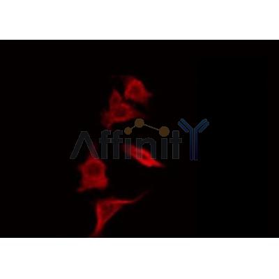 AF0203 staining HepG2 by IF/ICC. The sample were fixed with PFA and permeabilized in 0.1% Triton X-100,then blocked in 10% serum for 45 minutes at 25¡ãC. The primary antibody was diluted at 1/200 and incubated with the sample for 1 hour at 37¡ãC. An  Alexa Fluor 594 conjugated goat anti-rabbit IgG (H+L) Ab, diluted at 1/600, was used as the secondary antibod