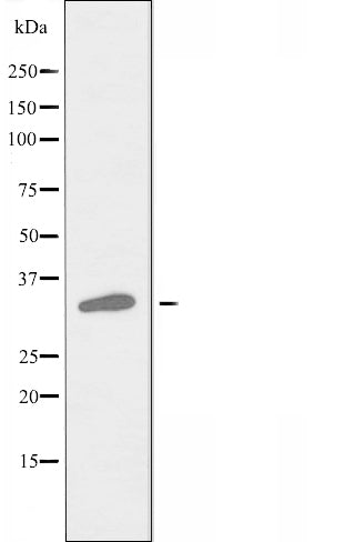 DF3761 at 1/100 staining Human breast cancer tissue by IHC-P. The sample was formaldehyde fixed and a heat mediated antigen retrieval step in citrate buffer was performed. The sample was then blocked and incubated with the antibody for 1.5 hours at 22¡ãC. An HRP conjugated goat anti-rabbit antibody was used as the secondary
