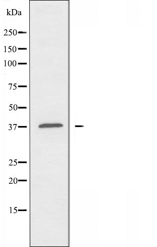 DF3762 staining Hela by IF/ICC. The sample were fixed with PFA and permeabilized in 0.1% Triton X-100,then blocked in 10% serum for 45 minutes at 25¡ãC. The primary antibody was diluted at 1/200 and incubated with the sample for 1 hour at 37¡ãC. An  Alexa Fluor 594 conjugated goat anti-rabbit IgG (H+L) Ab, diluted at 1/600, was used as the secondary antibod