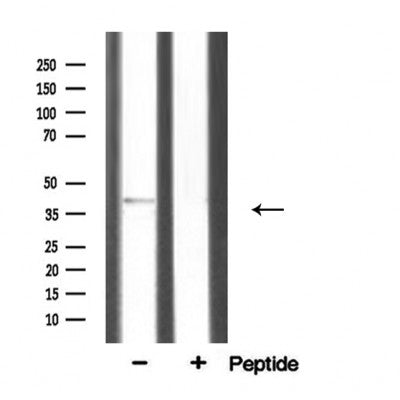 DF3764 staining HeLa cells by IF/ICC. The sample were fixed with PFA and permeabilized in 0.1% Triton X-100,then blocked in 10% serum for 45 minutes at 25¡ãC. The primary antibody was diluted at 1/200 and incubated with the sample for 1 hour at 37¡ãC. An  Alexa Fluor 594 conjugated goat anti-rabbit IgG (H+L) antibody(Cat.# S0006), diluted at 1/600, was used as secondary antibod