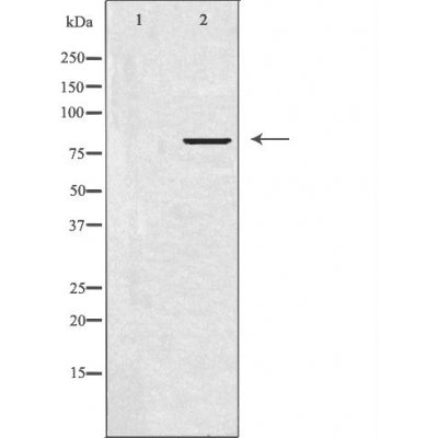 DF3769 at 1/100 staining Rat heart tissue by IHC-P. The sample was formaldehyde fixed and a heat mediated antigen retrieval step in citrate buffer was performed. The sample was then blocked and incubated with the antibody for 1.5 hours at 22¡ãC. An HRP conjugated goat anti-rabbit antibody was used as the secondary