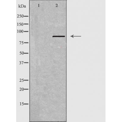 Western blot analysis of extracts from A549 cells using APLP2 antibody.The lane on the left is treated with the antigen-specific peptide.