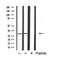 DF3781 staining  HeLa cells by IF/ICC. The sample were fixed with PFA and permeabilized in 0.1% Triton X-100,then blocked in 10% serum for 45 minutes at 25¡ãC. The primary antibody was diluted at 1/200 and incubated with the sample for 1 hour at 37¡ãC. An  Alexa Fluor 594 conjugated goat anti-rabbit IgG (H+L) antibody(Cat.# S0006), diluted at 1/600, was used as secondary antibod