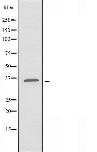 DF3786 at 1/100 staining Rat brain tissue by IHC-P. The sample was formaldehyde fixed and a heat mediated antigen retrieval step in citrate buffer was performed. The sample was then blocked and incubated with the antibody for 1.5 hours at 22¡ãC. An HRP conjugated goat anti-rabbit antibody was used as the secondary