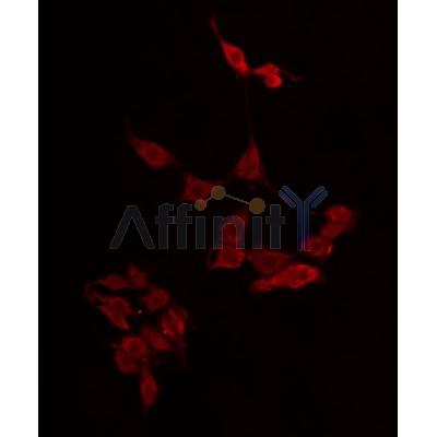 Western blot analysis of extracts from PC12, using APOL4 Antibody. The lane on the left was treated with blocking peptide.