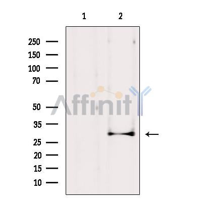 Western blot analysis of extracts from HepG2, using AQP1 Antibody. Lane 1 was treated with the blocking peptide.