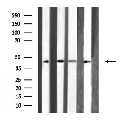 DF3790 staining Hela cells by IF/ICC. The sample were fixed with PFA and permeabilized in 0.1% Triton X-100,then blocked in 10% serum for 45 minutes at 25¡ãC. The primary antibody was diluted at 1/200 and incubated with the sample for 1 hour at 37¡ãC. An  Alexa Fluor 594 conjugated goat anti-rabbit IgG (H+L) antibody(Cat.# S0006), diluted at 1/600, was used as secondary antibod