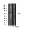 DF3794 at 1/100 staining Mouse liver tissue by IHC-P. The sample was formaldehyde fixed and a heat mediated antigen retrieval step in citrate buffer was performed. The sample was then blocked and incubated with the antibody for 1.5 hours at 22¡ãC. An HRP conjugated goat anti-rabbit antibody was used as the secondary