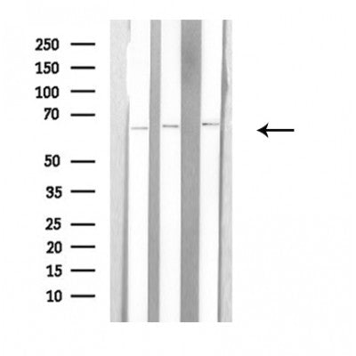 DF3795 staining Hela cells by IF/ICC. The sample were fixed with PFA and permeabilized in 0.1% Triton X-100,then blocked in 10% serum for 45 minutes at 25¡ãC. The primary antibody was diluted at 1/200 and incubated with the sample for 1 hour at 37¡ãC. An  Alexa Fluor 594 conjugated goat anti-rabbit IgG (H+L) antibody(Cat.# S0006), diluted at 1/600, was used as secondary antibod