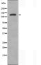 DF3799 staining HepG2 by IF/ICC. The sample were fixed with PFA and permeabilized in 0.1% Triton X-100,then blocked in 10% serum for 45 minutes at 25¡ãC. The primary antibody was diluted at 1/200 and incubated with the sample for 1 hour at 37¡ãC. An  Alexa Fluor 594 conjugated goat anti-rabbit IgG (H+L) Ab, diluted at 1/600, was used as the secondary antibod