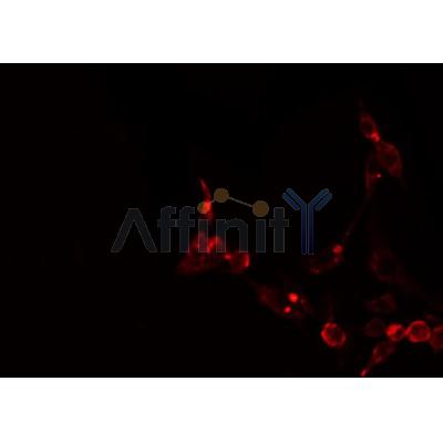 Western blot analysis of extracts from 293, using ATXN2L Antibody.