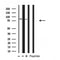 Western blot analysis of ATXN7L2 expression in various lysates