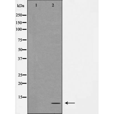 DF3803 staining COLO205 by IF/ICC. The sample were fixed with PFA and permeabilized in 0.1% Triton X-100,then blocked in 10% serum for 45 minutes at 25¡ãC. The primary antibody was diluted at 1/200 and incubated with the sample for 1 hour at 37¡ãC. An  Alexa Fluor 594 conjugated goat anti-rabbit IgG (H+L) Ab, diluted at 1/600, was used as the secondary antibod