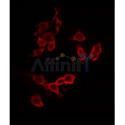 Western blot analysis of extracts from mouse brain, using ATPG Antibody. Lane 1 was treated with the antigen-specific peptide.