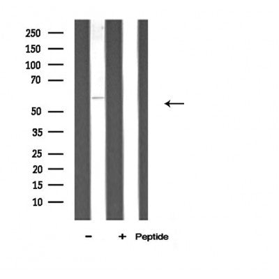 DF3806 staining 293 by IF/ICC. The sample were fixed with PFA and permeabilized in 0.1% Triton X-100,then blocked in 10% serum for 45 minutes at 25¡ãC. The primary antibody was diluted at 1/200 and incubated with the sample for 1 hour at 37¡ãC. An  Alexa Fluor 594 conjugated goat anti-rabbit IgG (H+L) Ab, diluted at 1/600, was used as the secondary antibod