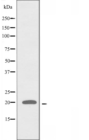 DF3807 staining A549 by IF/ICC. The sample were fixed with PFA and permeabilized in 0.1% Triton X-100,then blocked in 10% serum for 45 minutes at 25¡ãC. The primary antibody was diluted at 1/200 and incubated with the sample for 1 hour at 37¡ãC. An  Alexa Fluor 594 conjugated goat anti-rabbit IgG (H+L) Ab, diluted at 1/600, was used as the secondary antibod