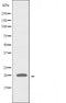 DF3807 staining A549 by IF/ICC. The sample were fixed with PFA and permeabilized in 0.1% Triton X-100,then blocked in 10% serum for 45 minutes at 25¡ãC. The primary antibody was diluted at 1/200 and incubated with the sample for 1 hour at 37¡ãC. An  Alexa Fluor 594 conjugated goat anti-rabbit IgG (H+L) Ab, diluted at 1/600, was used as the secondary antibod