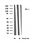 DF3809 staining 293 by IF/ICC. The sample were fixed with PFA and permeabilized in 0.1% Triton X-100,then blocked in 10% serum for 45 minutes at 25¡ãC. The primary antibody was diluted at 1/200 and incubated with the sample for 1 hour at 37¡ãC. An  Alexa Fluor 594 conjugated goat anti-rabbit IgG (H+L) Ab, diluted at 1/600, was used as the secondary antibod